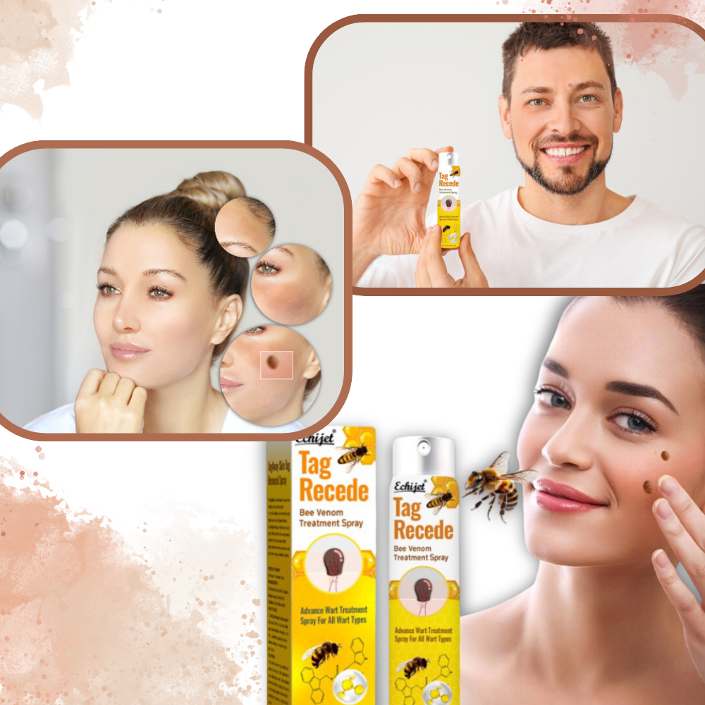 Non-Invasive Tag Recede - Ozerty